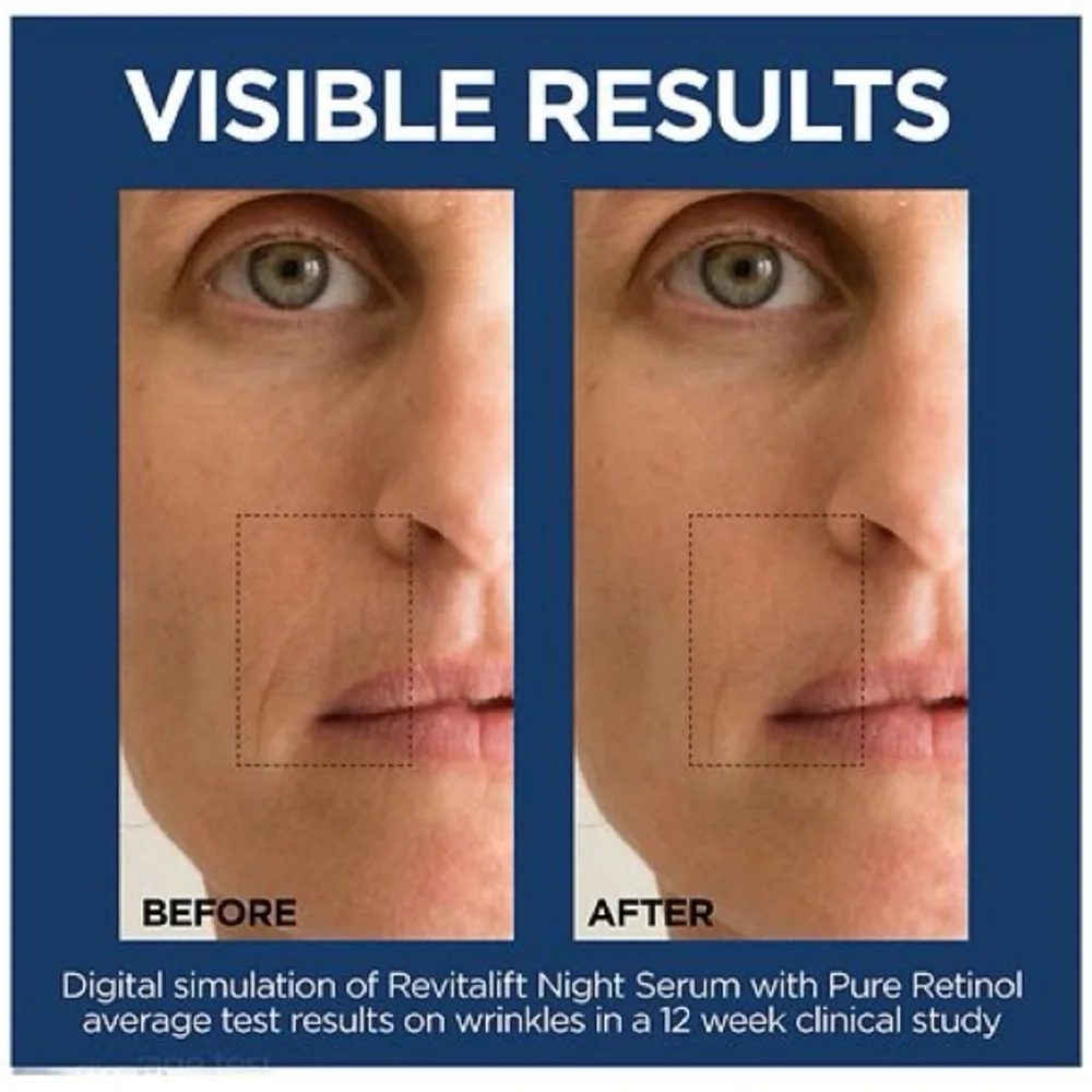 L'Oreal Revitalift Blue & Silver Serum Duo fine lines, wrinkles & dark circles